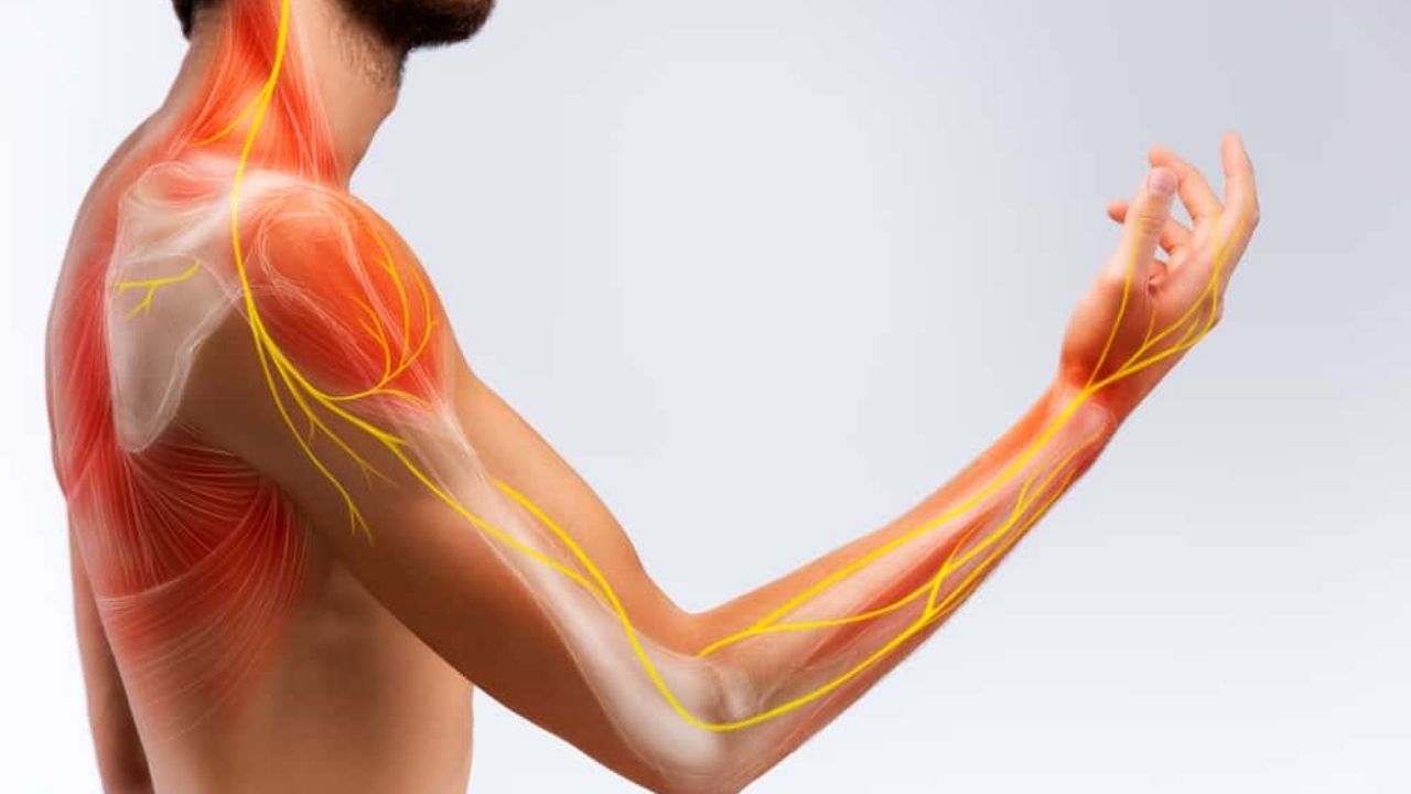 Cervicobraquialgia