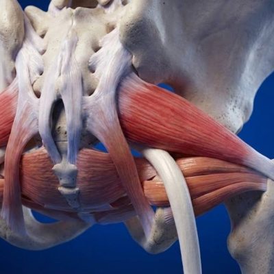 Síndrome da Cauda Equina